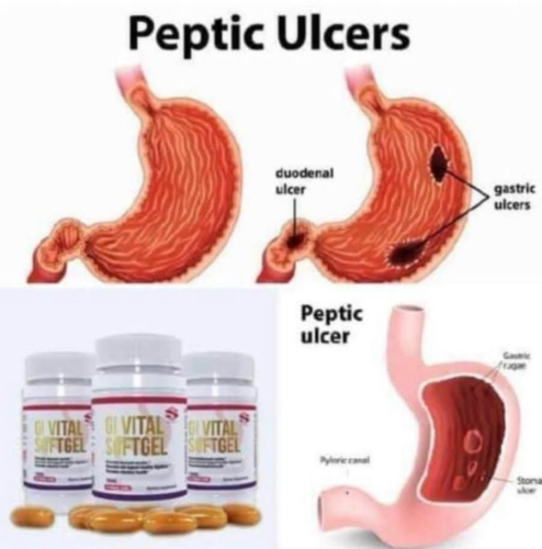 Gi Vital Perfect Ulcer Solution